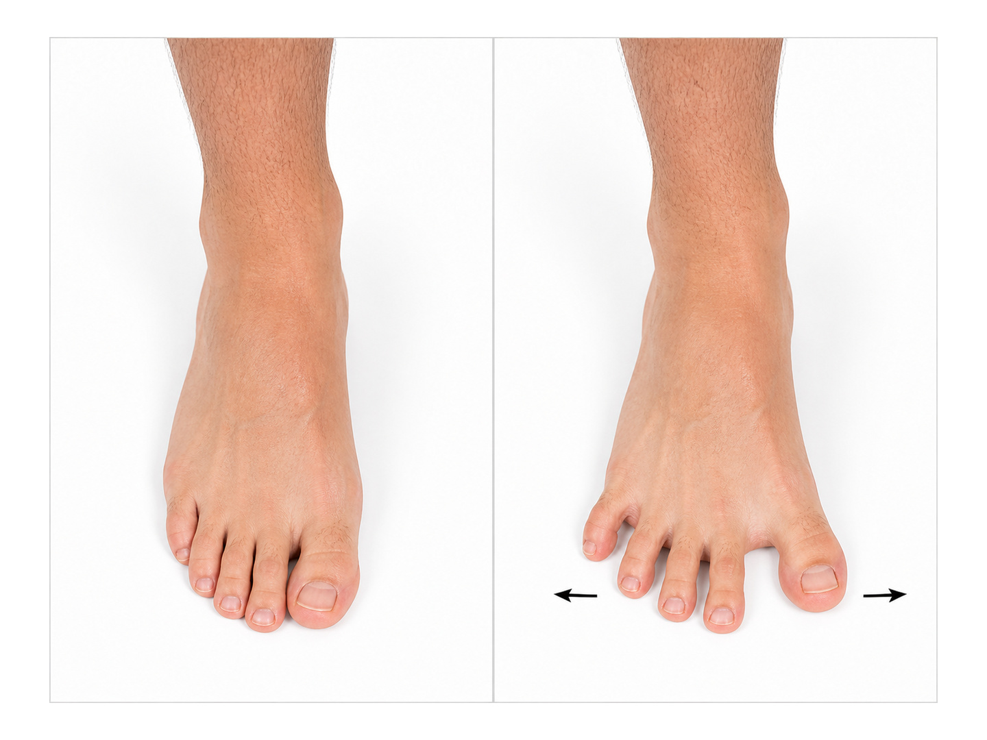 Toe Spreading: start and finish positions